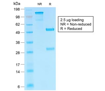 HCG-beta Antibody