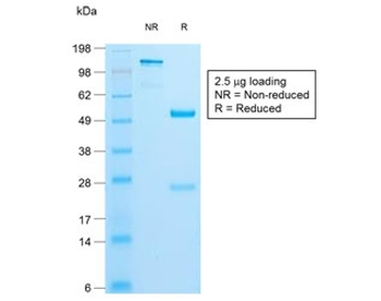 Insulin Antibody
