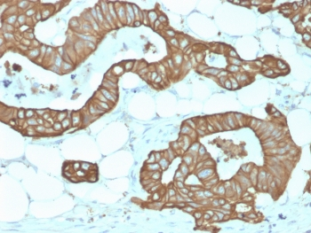 KRT19 Antibody / Cytokeratin 19