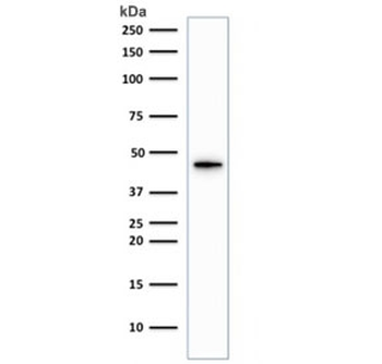 KRT19 Antibody / Cytokeratin 19