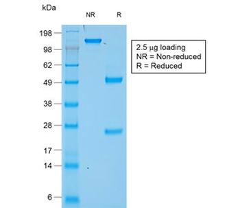 Chromogranin A Antibody