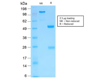 MMP3 Antibody / Matrix Metalloproteinase 3