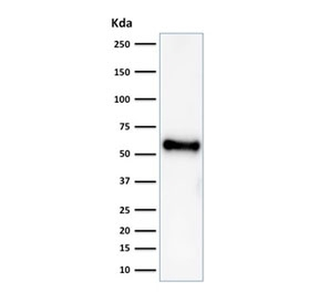 p53 Antibody / TP53 N-Terminal Region