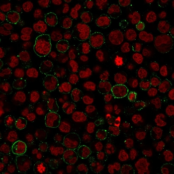 CD45 Antibody (Leukocyte marker)
