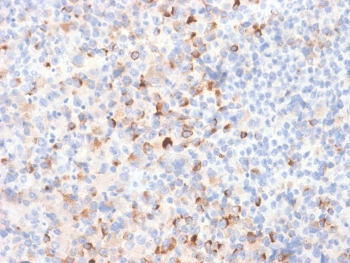 Tyrosinase Antibody