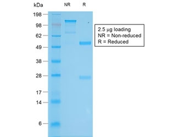 Tyrosinase Antibody