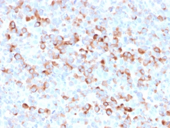 Tyrosinase Antibody