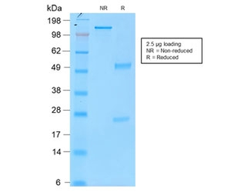 Tyrosinase Antibody