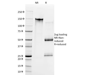 Cyclin E1 Antibody / CCNE1