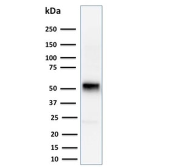 Cyclin E1 Antibody / CCNE1