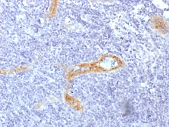 von Willebrand Factor Antibody / vWF