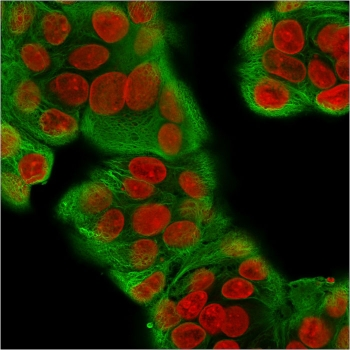Multi Cytokeratin Antibody