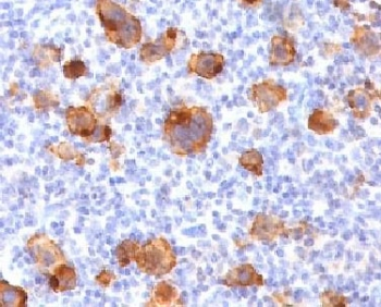 CD30 Antibody