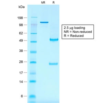 CD30 Antibody