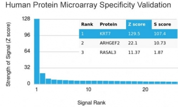 KRT7 Antibody / Cytokeratin 7