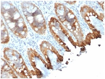 Cytokeratin 8/18 Antibody
