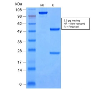 Cytokeratin 8/18 Antibody