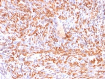 Calponin 1 Antibody