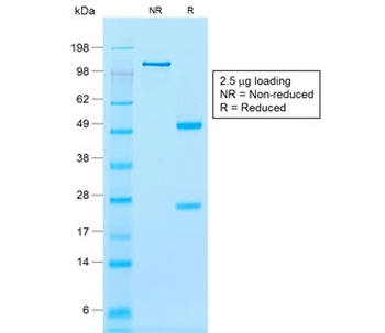 Calponin 1 Antibody