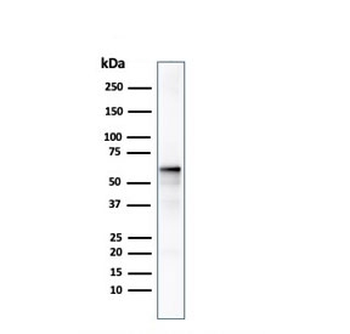AKT1 Antibody