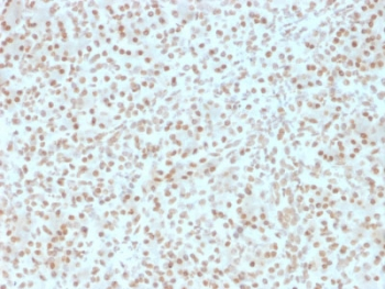 AKT1 Antibody