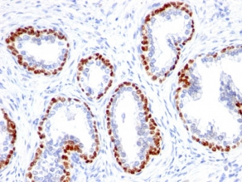 p63 Antibody / Tumor protein 63