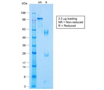 p63 Antibody / Tumor protein 63