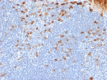 Kappa Light Chain Antibody