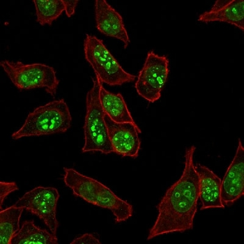 Ki67 Antibody