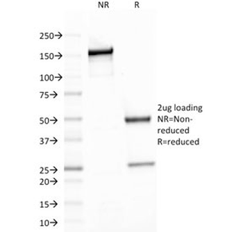 SPTBN2 Antibody / Spectrin beta III