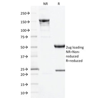 CD10 Antibody / Neprilysin
