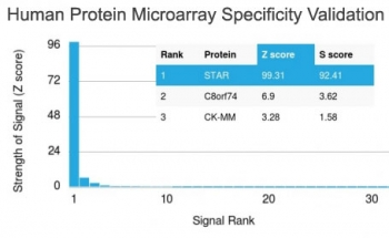 StAR Antibody / Steroidogenic acute regulatory protein