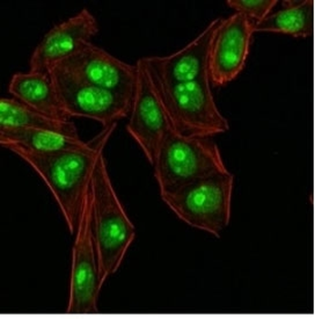 Nucleophosmin Antibody