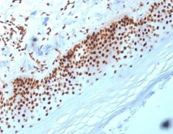 Nucleophosmin Antibody