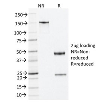 Nucleophosmin Antibody