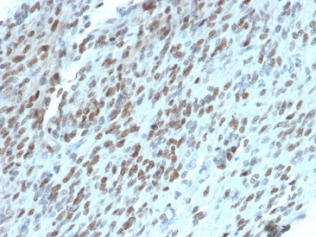 TLE1 Antibody / Transducin-like enhancer protein 1