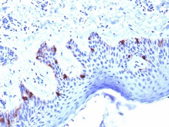 PMEL17 / Melanoma gp100 Antibody