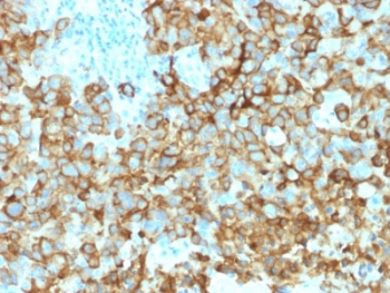 PMEL17 / Melanoma gp100 Antibody