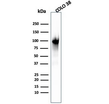 PMEL17 / Melanoma gp100 Antibody