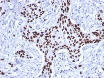 p53 Antibody / TP53