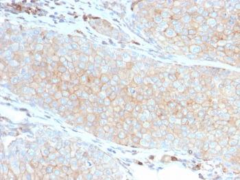 PD-L1 Antibody / B7-H1 / CD274