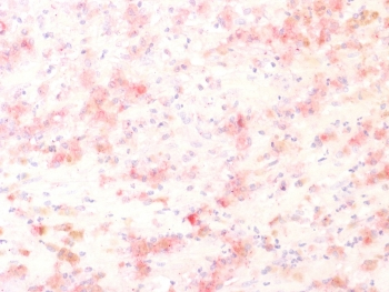 TRP1 / Tyrosinase-Related Protein-1 Antibody