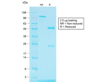TRP1 / Tyrosinase-Related Protein-1 Antibody