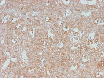 Neurofilament Antibody (-Light) / NF-L / NEFL