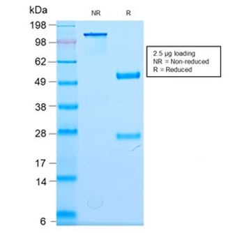 Neurofilament Antibody (-Light) / NF-L / NEFL