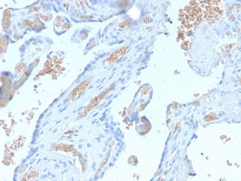 SPTA1 Antibody / Spectrin alpha 1
