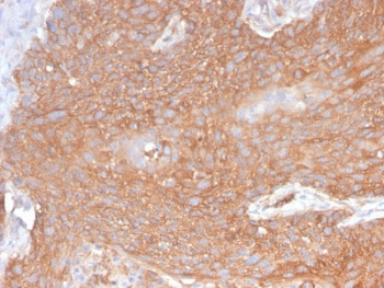 SPTBN2 Antibody / Spectrin beta III