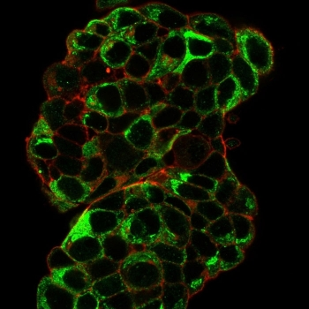 Estrogen Inducible Protein pS2 / TFF1 Antibody