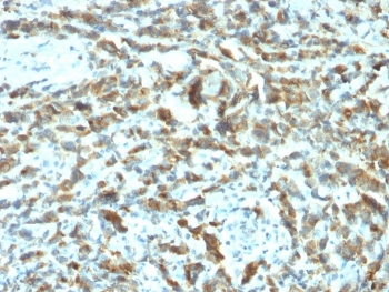 Estrogen Inducible Protein pS2 / TFF1 Antibody