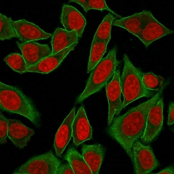 SPTBN2 Antibody / Spectrin beta III